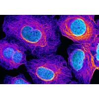 Флуоресцентная микроскопия